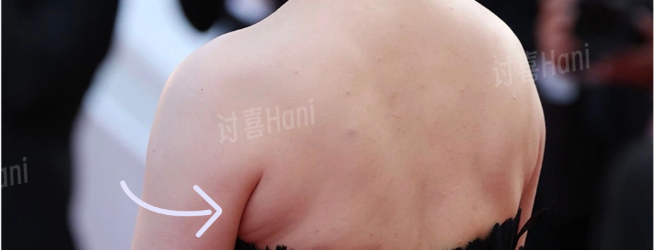拍婚纱照牙齿太丑怎么办_牙齿不好看婚纱照表情管理_婚纱照牙齿不好看会给修嘛