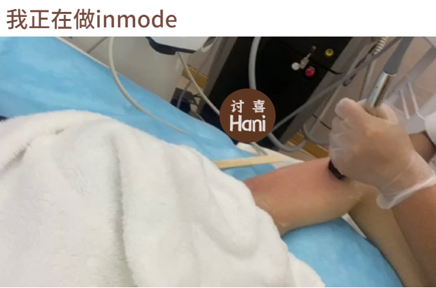 牙齿不好看婚纱照表情管理_婚纱照牙齿不好看会给修嘛_拍婚纱照牙齿太丑怎么办