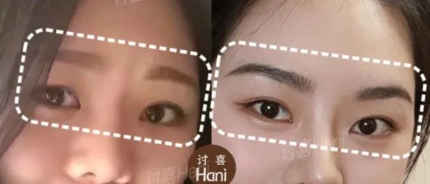 拍婚纱照牙齿太丑怎么办_牙齿不好看婚纱照表情管理_婚纱照牙齿不好看会给修嘛