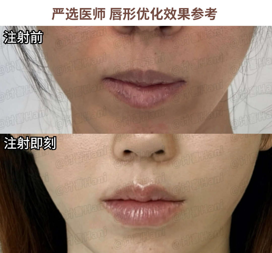 拍婚纱照牙齿太丑怎么办_婚纱照牙齿不好看会给修嘛_牙齿不好看婚纱照表情管理