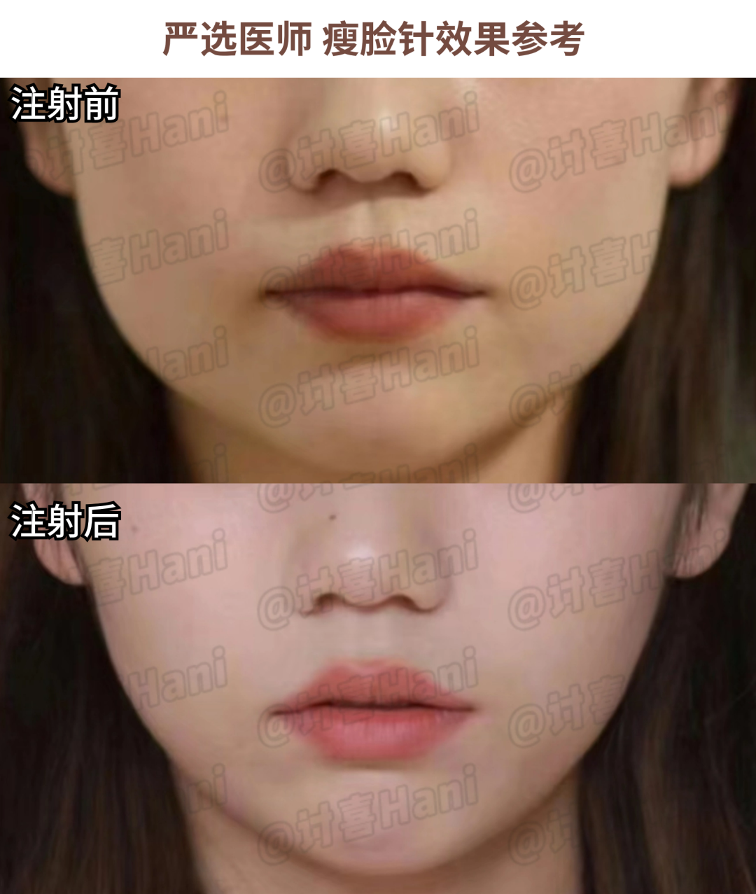 婚纱照牙齿不好看会给修嘛_拍婚纱照牙齿太丑怎么办_牙齿不好看婚纱照表情管理