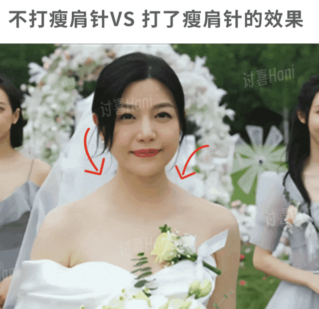 牙齿不好看婚纱照表情管理_婚纱照牙齿不好看会给修嘛_拍婚纱照牙齿太丑怎么办