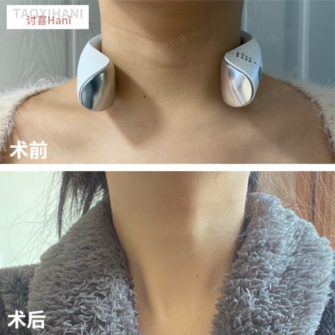 牙齿不好看婚纱照表情管理_拍婚纱照牙齿太丑怎么办_婚纱照牙齿不好看会给修嘛