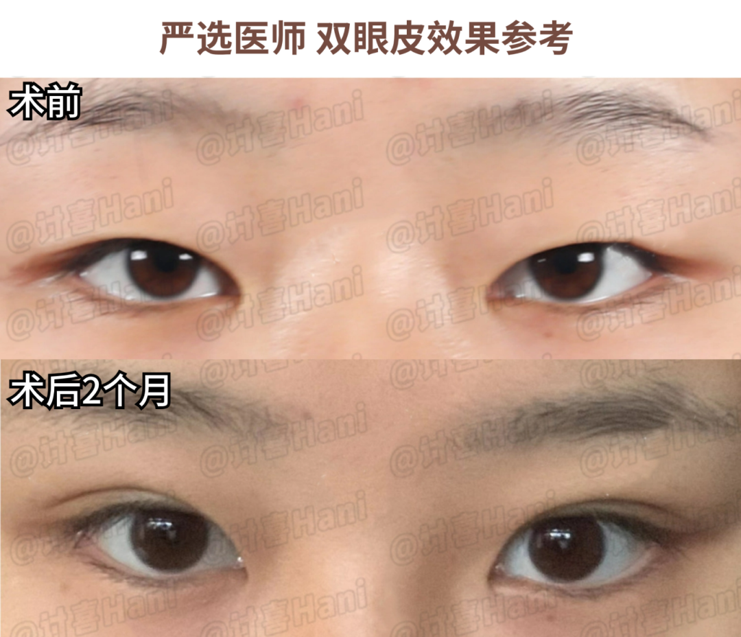 牙齿不好看婚纱照表情管理_婚纱照牙齿不好看会给修嘛_拍婚纱照牙齿太丑怎么办