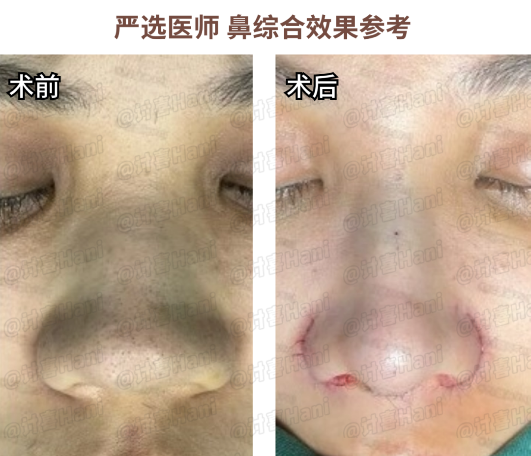 拍婚纱照牙齿太丑怎么办_婚纱照牙齿不好看会给修嘛_牙齿不好看婚纱照表情管理