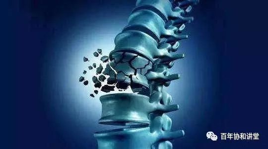 有耳石症能运动吗_耳石症能运动吗_耳石症不能剧烈运动