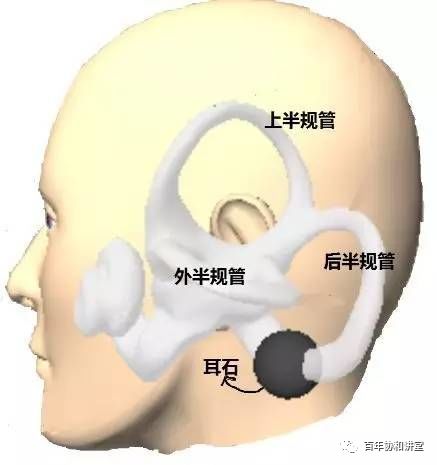 有耳石症能运动吗_耳石症能运动吗_耳石症不能剧烈运动