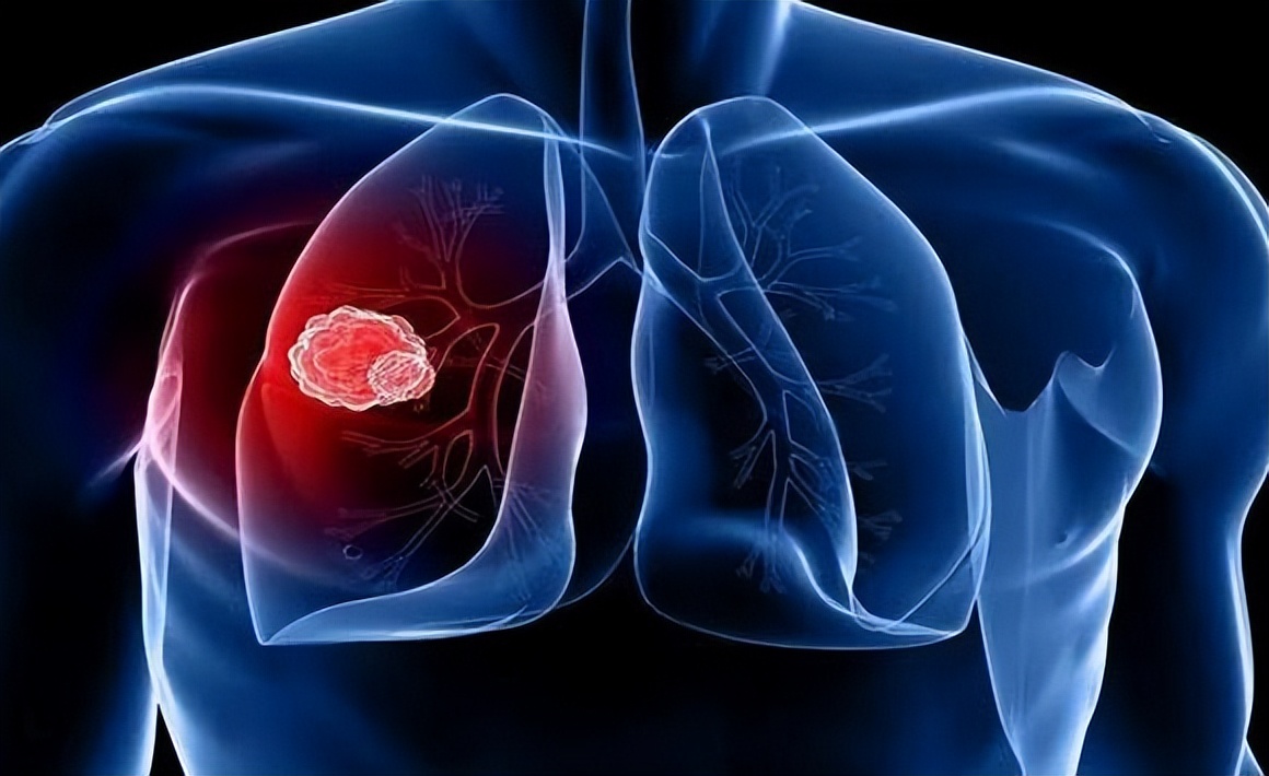 有糖尿病算健康还是亚健康_亚健康影响糖尿病吗吗_病亚糖尿健康影响生育吗